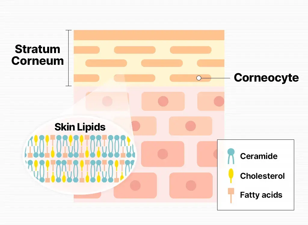 ceramide, cholestrol and fatty acid role