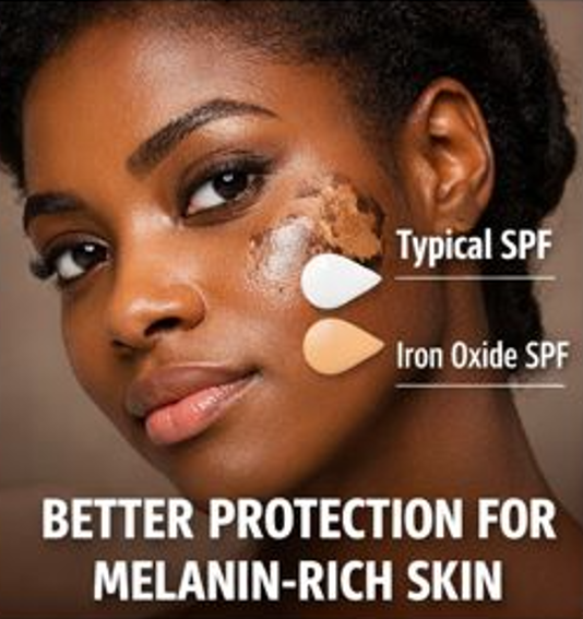 Comparison of typical SPF and iron oxide sunscreen on melanin-rich skin, highlighting improved pigmentation protection.