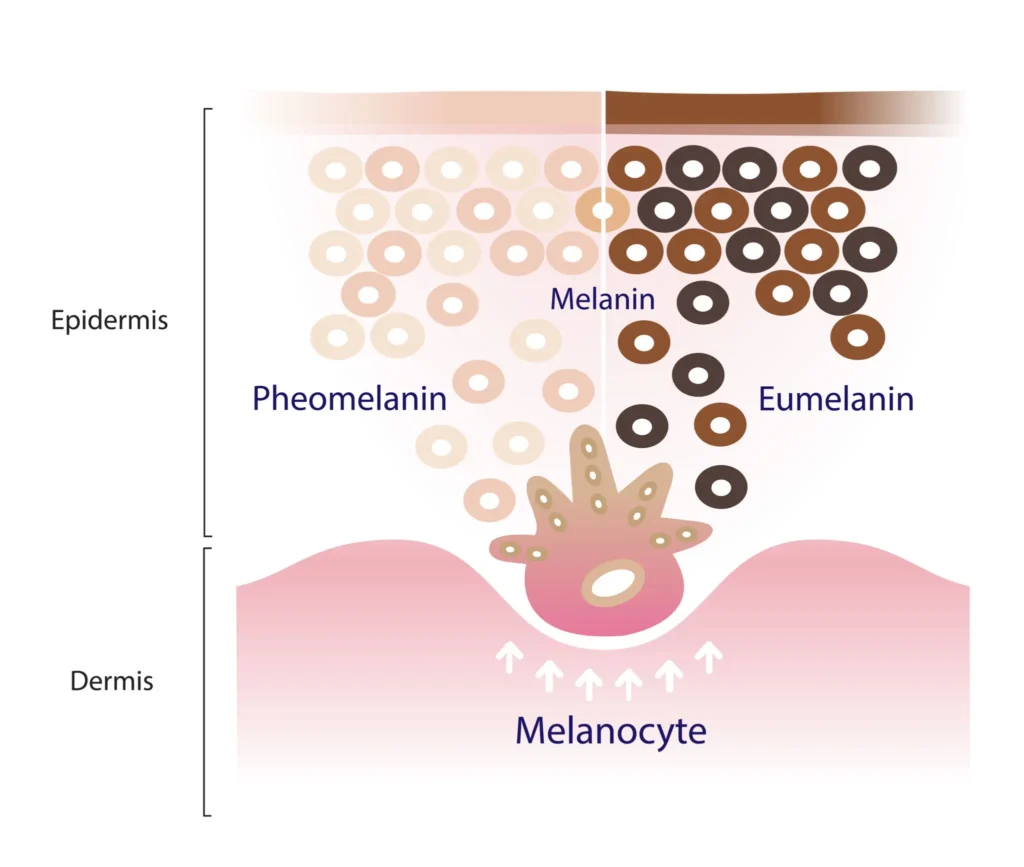 Graphic comparing superficial and deep pigmentation in skin layers