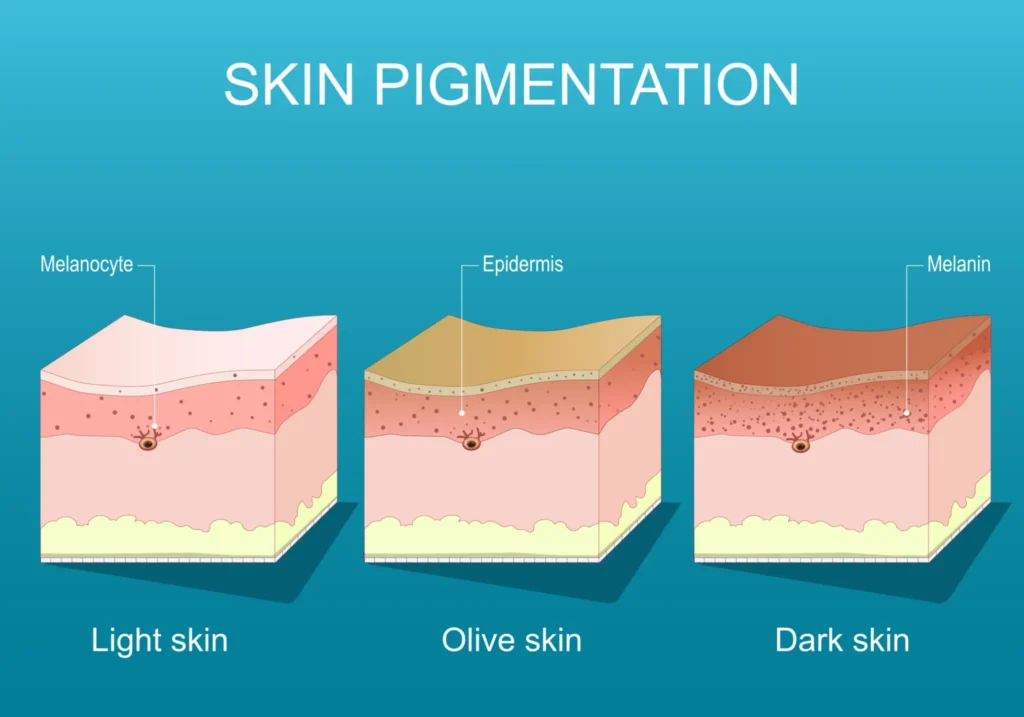 Graphic-comparing-superficial-and-deep-pigmentation-in-skin-layers-image-2.webp