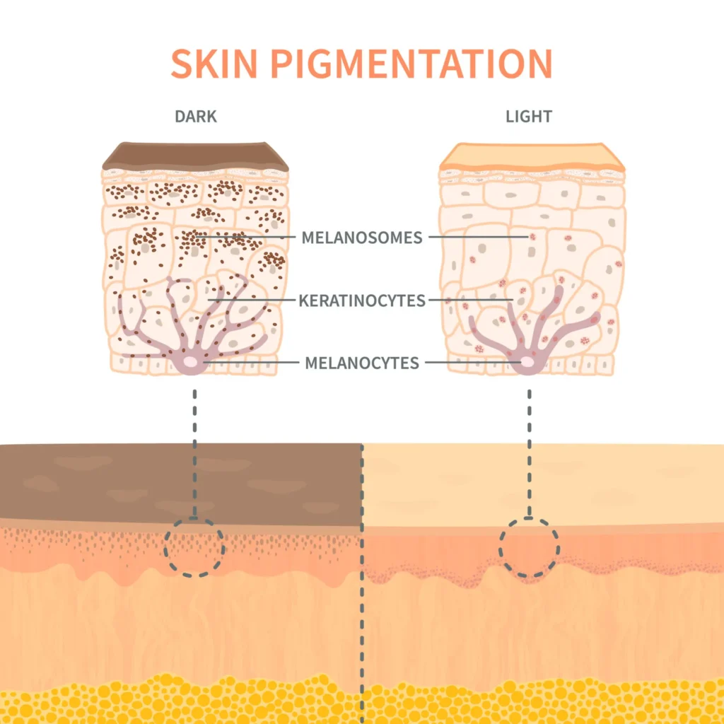 Graphic-comparing-superficial-and-deep-pigmentation-in-skin-layers-image-3.webp