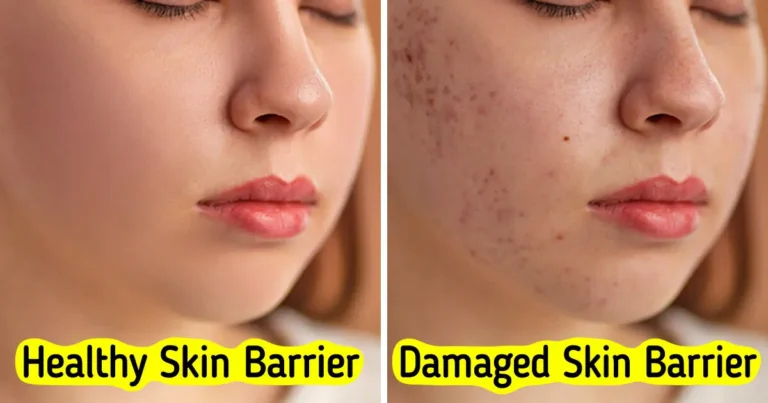 Healthy skin barrier allowing even light reflection