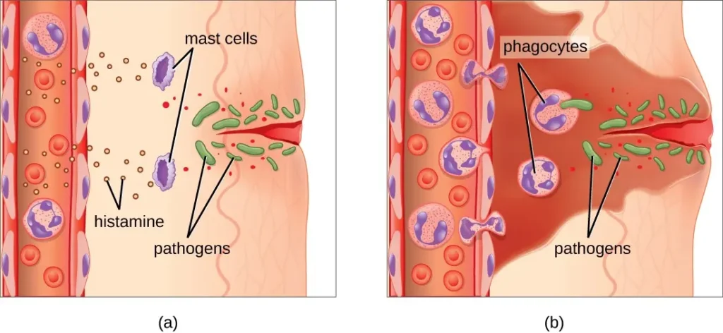 Heat and infrared radiation worsening skin pigmentation through inflammation image 3