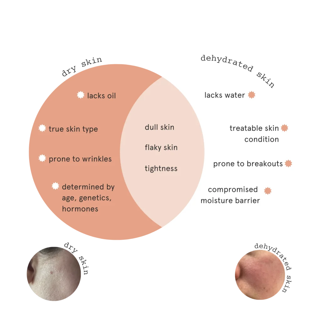 Inflammation disrupting skin radiance without pigmentation