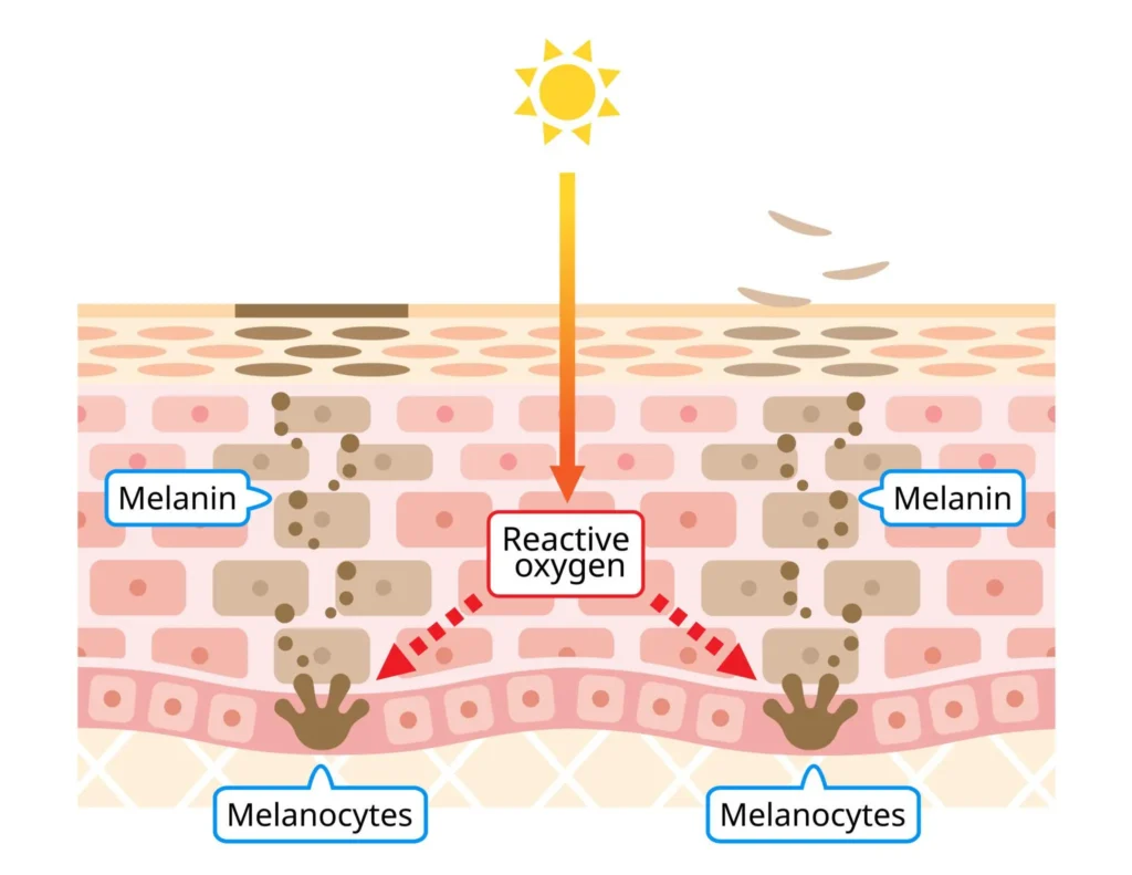 Melanocyte Activity & Memory-Why Pigmentation Returns After Stopping Treatment