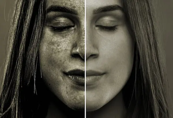 Environmental damage counteracting pigmentation treatment image 1