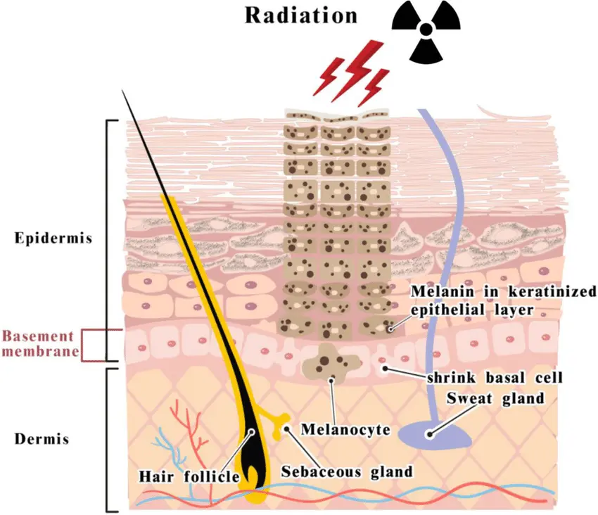 Heat exposure triggering inflammation and pigmentation