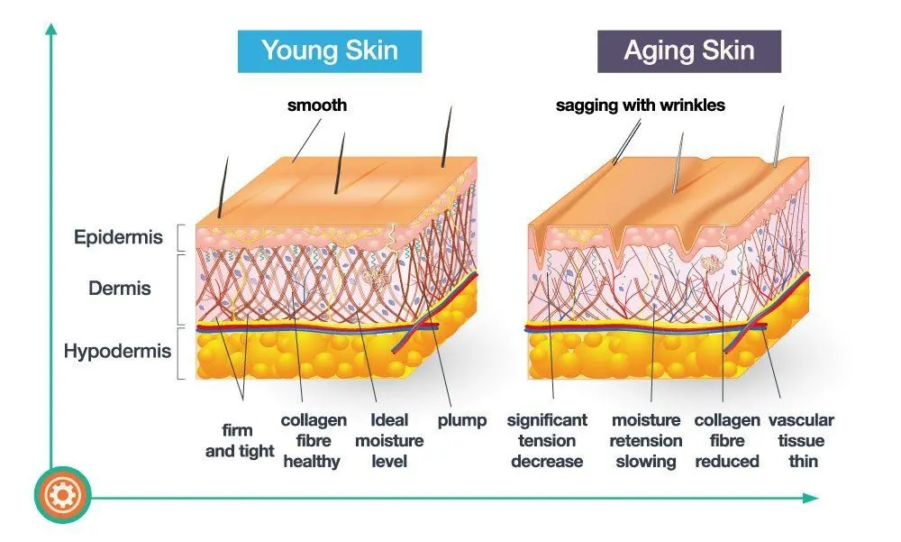 Photodamage causing dull skin before pigmentation appears 2