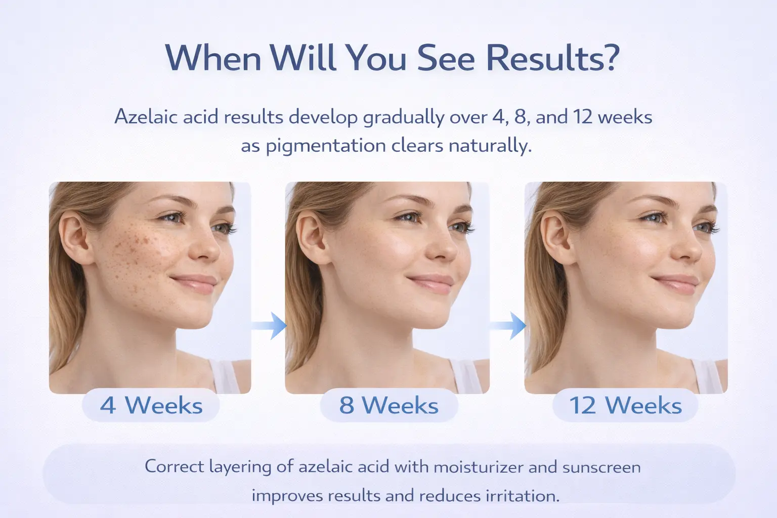 how long azelaic acid takes to work pigmentation improvement timeline 4 8 12 weeks.